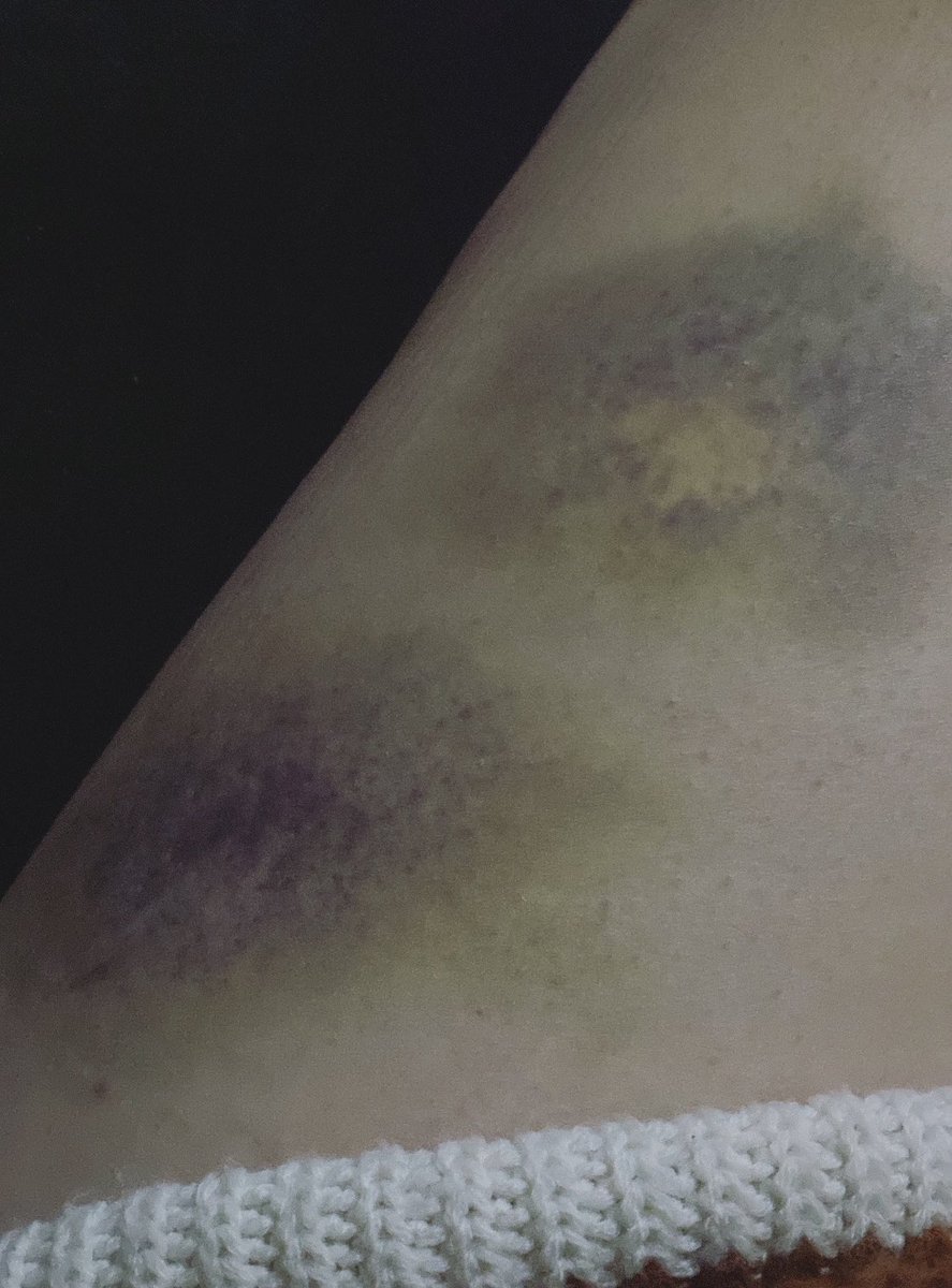 me pega porq me ama 🥹❤️