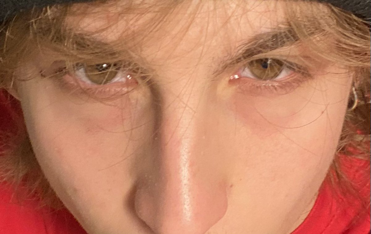 Necesito dormir un poco te lo digo, mis ojos van a explotar