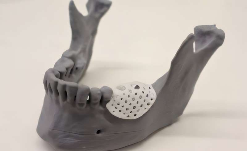 Valuemed_Canada's tweet photo. Clinicians achieve groundbreaking success with custom 3D-printed bone scaffolds to rebuild a jawbone, showcasing cutting-edge innovation in medical technology. Read the full article to explore this remarkable advancement: https://t.co/Mswyx8MM2B https://t.co/KHDvzEzaKE