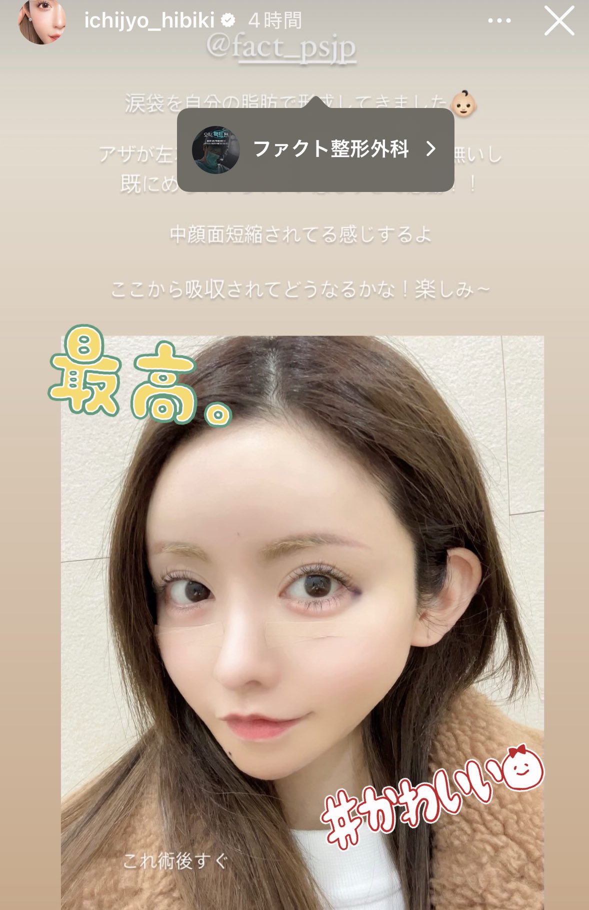 一条 響 整形