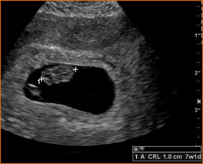 RadEverything's tweet photo. Patient : I'm a virgin
USS : https://t.co/L8tXotjN0m