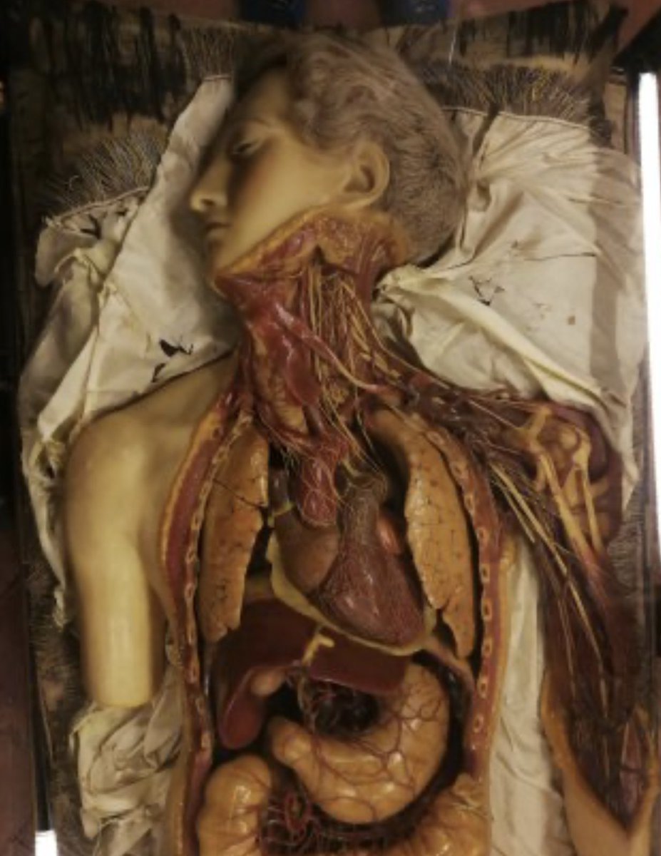 Simone Peschillo, M.D., Ph.D. (@s_pesch) on Twitter photo Gaetano G. Zummo (1656-1701), an eminent wax artist, dedicated his entire life to creating extraordinary wax works, especially anatomical ones, during a time when it was not possible to study anatomy on cadavers. Examples from Specola in Florence <a href="/PeterMLawrence1/">Peter M. Lawrence</a> #anatomy #brain Gaetano G. Zummo (1656-1701), an eminent wax artist, dedicated his entire life to creating extraordinary wax works, especially anatomical ones, during a time when it was not possible to study anatomy on cadavers. Examples from Specola in Florence <a href="/PeterMLawrence1/">Peter M. Lawrence</a> #anatomy #brain