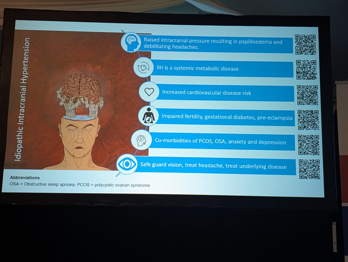 UK_headache's tweet photo. Importance of the #Eye in headache/neurology @DrMollan. Important not to miss transient monocular visual loss (imminent stroke risk). Also dry eye, visual snow, glaucoma, uveitis, GCA (cranial only may not inflammatory changes).
Fundoscopy is key.
#bashhead @uhbtrust #MedEd https://t.co/t3OxAgOslP