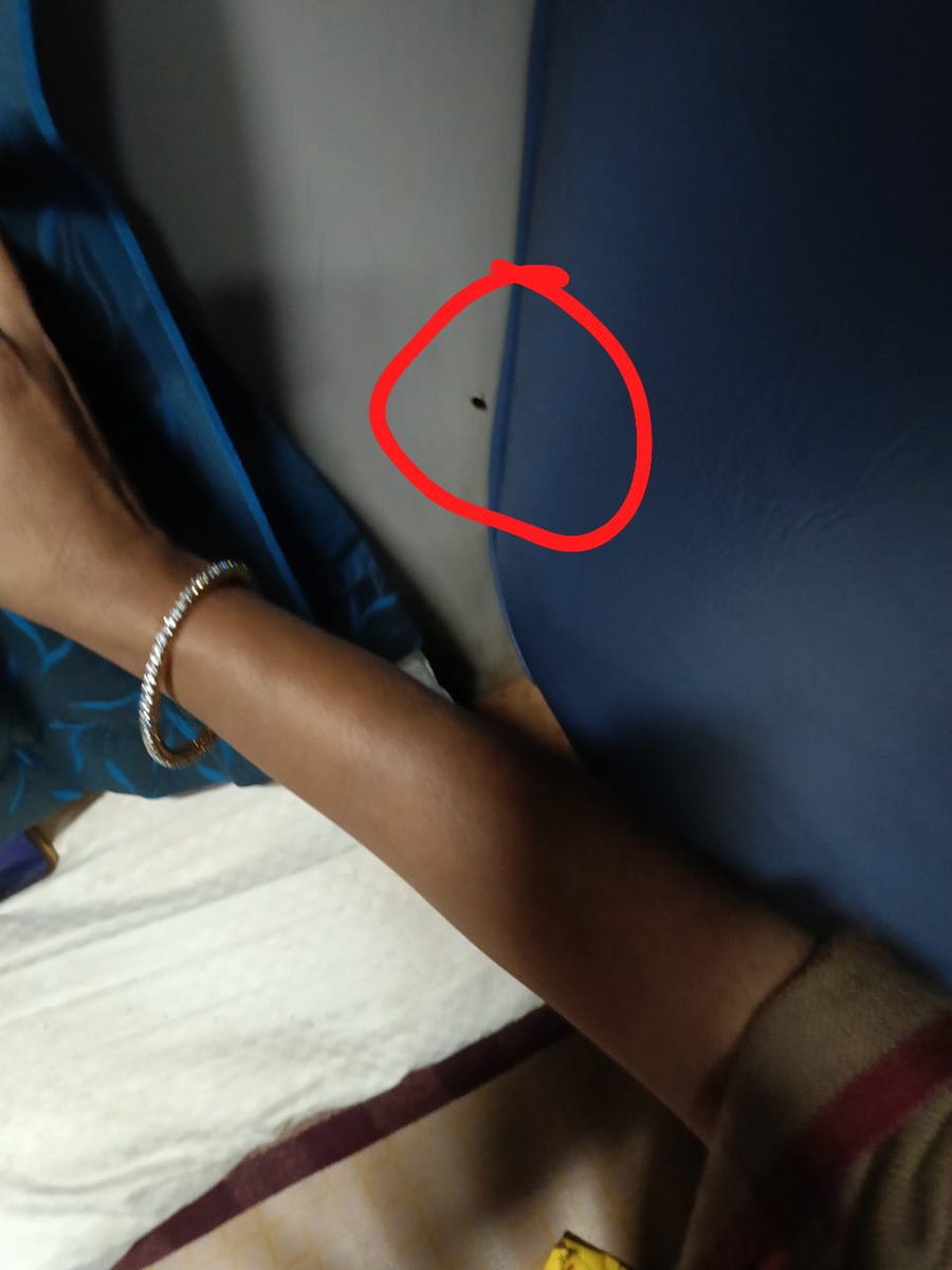 NCCTinsukia's tweet photo. 1. Severe infestation of cockroaches in the coach, creating an unhygienic and unpleasant environment for passengers. #CleanTrains https://t.co/uV9QwsAgS2