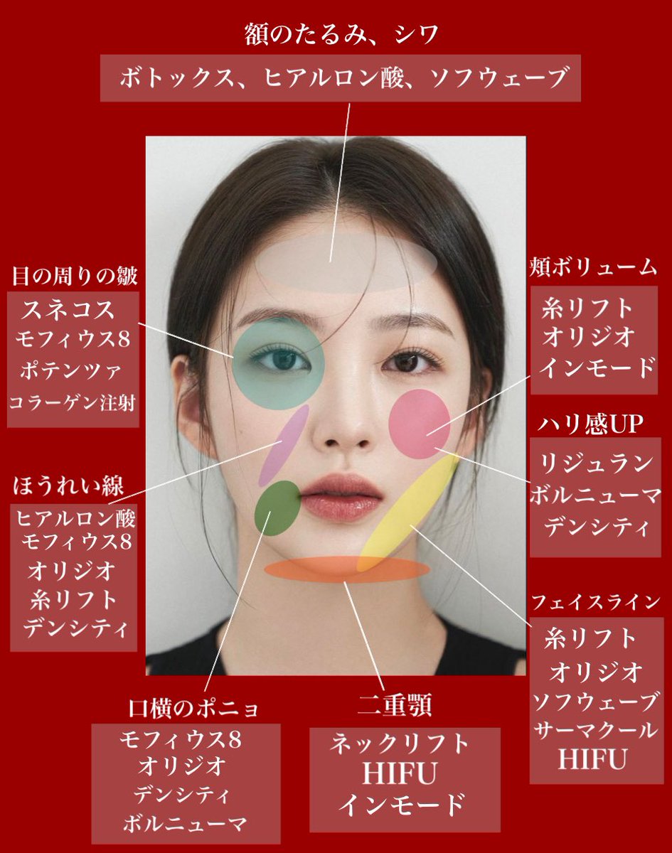 mtgjdpa's tweet photo. 切らない若返り整形の種類全貌🔻
.
✅目周りの皺
スネコス
モフィウス8
ポテンツァ
コラーゲン注射

✅法令線
貴族フィラー
糸リフト
オリジオ
モウフィス8
デンシティ

✅頬ボリューム
糸リフト
オリジオ
インモード

✅ハリ感UP
リジュラン
ボルニューマ
デンシティ

✅フェイスライン
糸リフト
オリジオ
ソフウェーブ
サーマクール
HIFU

✅口横のポニョ
モウフィス8
デンシティ
オリジオ
ボルニューマ

✅二重顎
ネックリフト
HIFU
インモード

✅額のたるみや皺
ボトックス
ヒアルロン酸
ソフウェーブ