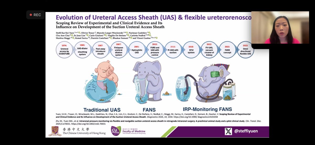 Renato Nardi Pedro (@rnpedro_uro) on Twitter photo <a href="/steffiyuen/">Steffi Yuen</a> <a href="/KUendourology/">WMolinaKUendouro</a> <a href="/OTRAXER/">Olivier Traxer</a> <a href="/DrBenChew/">Dr. Ben Chew</a> great talks on RIRS and SUCTION! Moderated by Vineet Gauhar and Wen Zhong.
Organized by The Chinese University of Hong Kong.
AI will assist Endourologist sooner that expected (at least by me) <a href="/steffiyuen/">Steffi Yuen</a> <a href="/KUendourology/">WMolinaKUendouro</a> <a href="/OTRAXER/">Olivier Traxer</a> <a href="/DrBenChew/">Dr. Ben Chew</a> great talks on RIRS and SUCTION! Moderated by Vineet Gauhar and Wen Zhong.
Organized by The Chinese University of Hong Kong.
AI will assist Endourologist sooner that expected (at least by me)