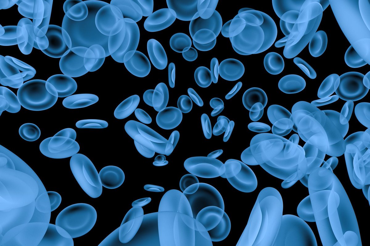 Blood Cancers Today (@blood_cancers) on Twitter photo Adding venetoclax to intensive chemotherapy with cladribine, idarubicin, and cytarabine resulted in deep and durable remissions in young, fit patients with newly diagnosed #AML or #MDS, according to a study presented by <a href="/TapKadia/">Tapan Kadia</a> of <a href="/MDAndersonNews/">MD Anderson Cancer Center</a>.
📰 buff.ly/42ozFT8 Adding venetoclax to intensive chemotherapy with cladribine, idarubicin, and cytarabine resulted in deep and durable remissions in young, fit patients with newly diagnosed #AML or #MDS, according to a study presented by <a href="/TapKadia/">Tapan Kadia</a> of <a href="/MDAndersonNews/">MD Anderson Cancer Center</a>.
📰 buff.ly/42ozFT8