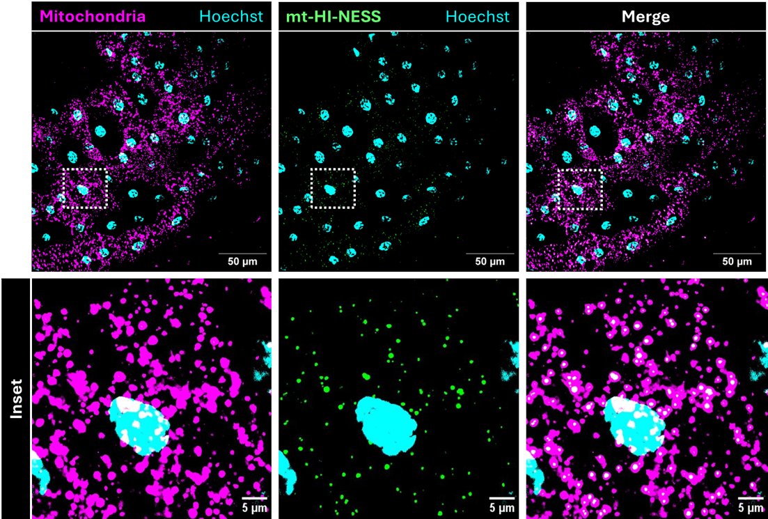 ShuttLab (@mitomorph) on Twitter photo Finally, through collaborations, we show that the reporter works in budding yeast (with Francesco Padovani <a href="/frank_pado/">Francesco Padovani</a> in Kurt Schmoller's lab <a href="/SchmollerLab/">Kurt Schmoller</a>) and in Drosophila (Mashiat again, with help from Abhi Sharma in Savraj Grewal's lab @SavrajGrewal). Finally, through collaborations, we show that the reporter works in budding yeast (with Francesco Padovani <a href="/frank_pado/">Francesco Padovani</a> in Kurt Schmoller's lab <a href="/SchmollerLab/">Kurt Schmoller</a>) and in Drosophila (Mashiat again, with help from Abhi Sharma in Savraj Grewal's lab @SavrajGrewal).