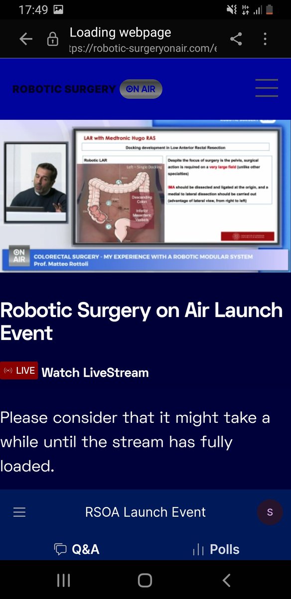Portsmouth Colorectal (@pcolorectal) on Twitter photo #RSOA
#ROBOTICSURGERYONAIR
#RoboticsOnAir
join the live syream now
<a href="/JimkhanMD/">Jim Khan</a> <a href="/PiozziMD/">Guglielmo Niccolò Piozzi</a> <a href="/ACPGBI/">@ACPGBI</a> <a href="/ACPGBI_EduTrain/">ACPGBI-Education&Training</a> <a href="/IntuitiveSurg/">Intuitive</a> <a href="/CMRSurgical/">CMR Surgical</a> <a href="/Medtronic/">Medtronic</a> <a href="/escp_tweets/">European Society of Coloproctology</a> #RSOA
#ROBOTICSURGERYONAIR
#RoboticsOnAir
join the live syream now
<a href="/JimkhanMD/">Jim Khan</a> <a href="/PiozziMD/">Guglielmo Niccolò Piozzi</a> <a href="/ACPGBI/">@ACPGBI</a> <a href="/ACPGBI_EduTrain/">ACPGBI-Education&Training</a> <a href="/IntuitiveSurg/">Intuitive</a> <a href="/CMRSurgical/">CMR Surgical</a> <a href="/Medtronic/">Medtronic</a> <a href="/escp_tweets/">European Society of Coloproctology</a>