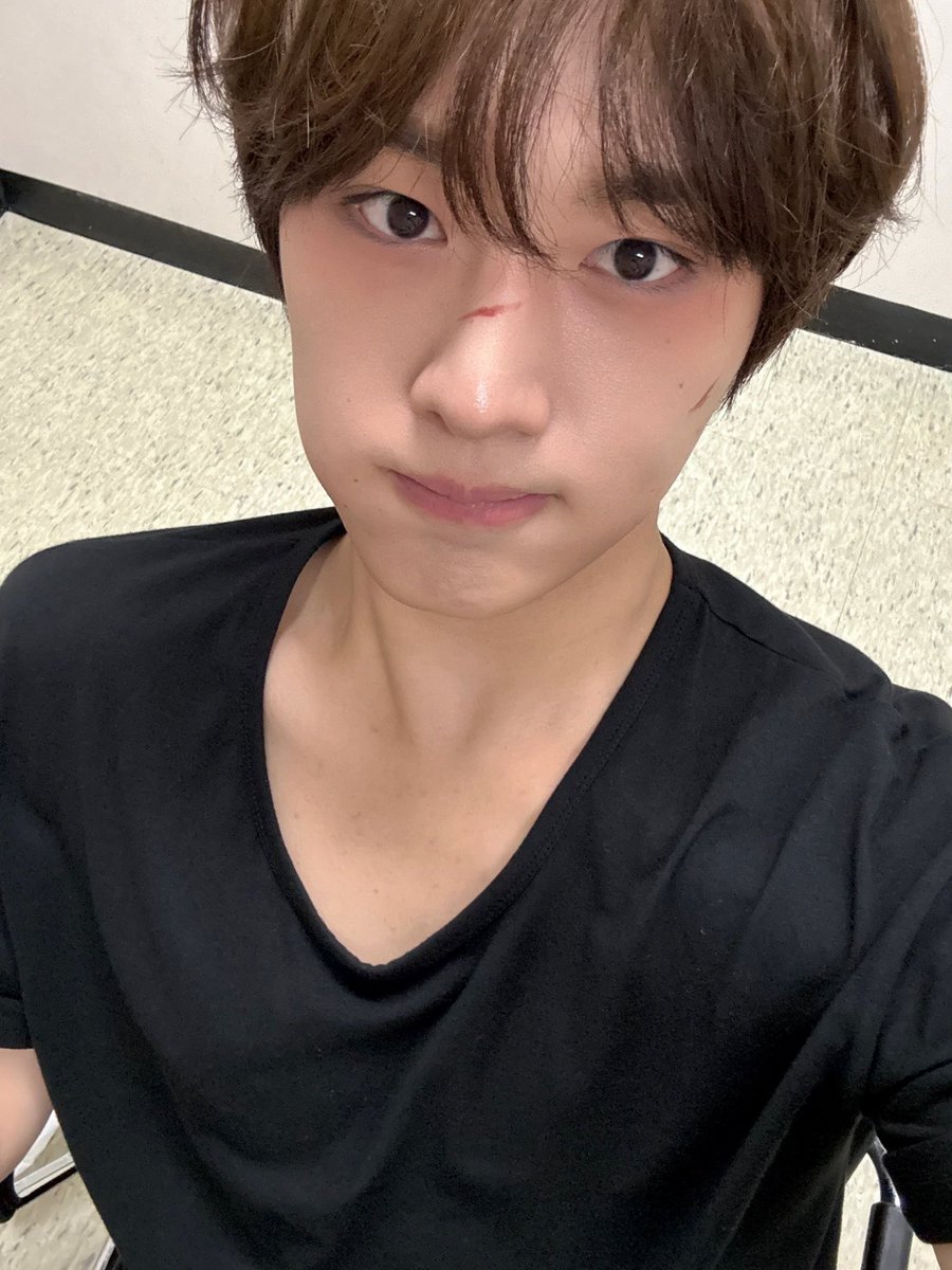 으아 상처 아프다..ㅎ🥹⚡️

#CIX #씨아이엑스 #현석 #윤현석 #서기 #막내 #FIX #픽스 #픽스내거