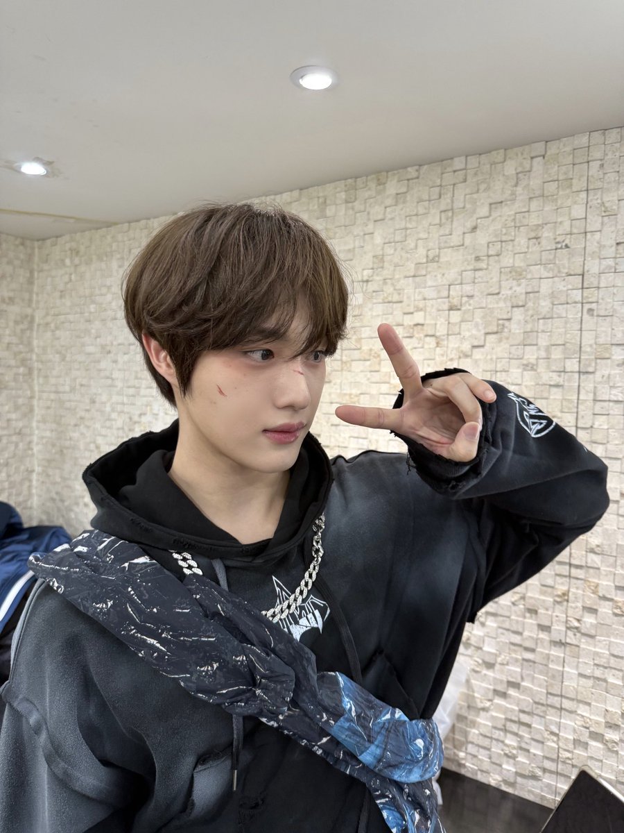 CIX_twt's tweet photo. 으아 상처 아프다..ㅎ🥹⚡️

#CIX #씨아이엑스 #현석 #윤현석 #서기 #막내 #FIX #픽스 #픽스내거 https://t.co/2NyMwRCGkE