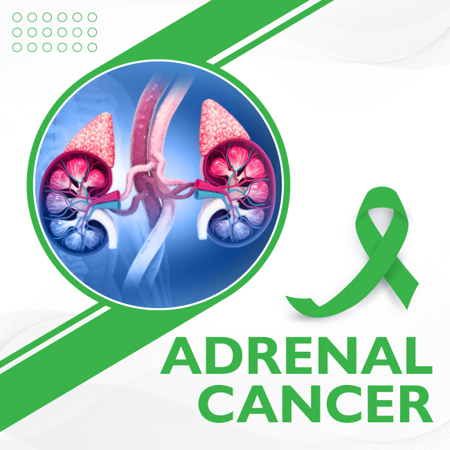 📣January is #AdrenalCancerAwarenessMonth.
Learn as much as you can about #pheo #paral #PPGL so that you can partner with your medical team for the best possible outcome.
pheopara.org/education