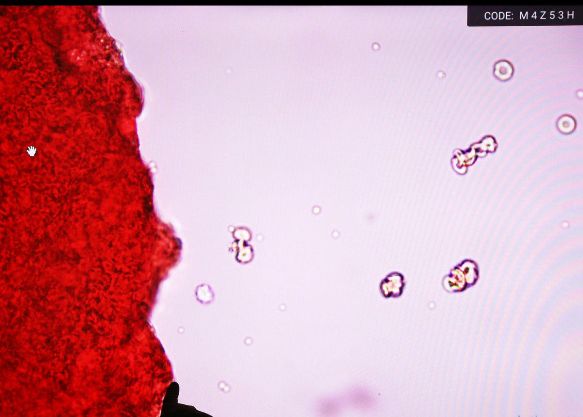 wbu2021's tweet photo. 🌟In an exciting laboratory session, our second-year dentistry🦷 students dove deep into the world of immune cells and antigen-antibody reactions.
#WBU #Dentistry #Immunology #FutureDentists https://t.co/QcowBfJzsQ