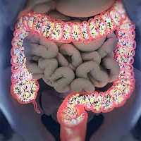 Insideout_pod's tweet photo. Cheap but highly effective thing to use for improving your gut health : 

Thread below  ⤵️ https://t.co/hoKYCAt8Zu