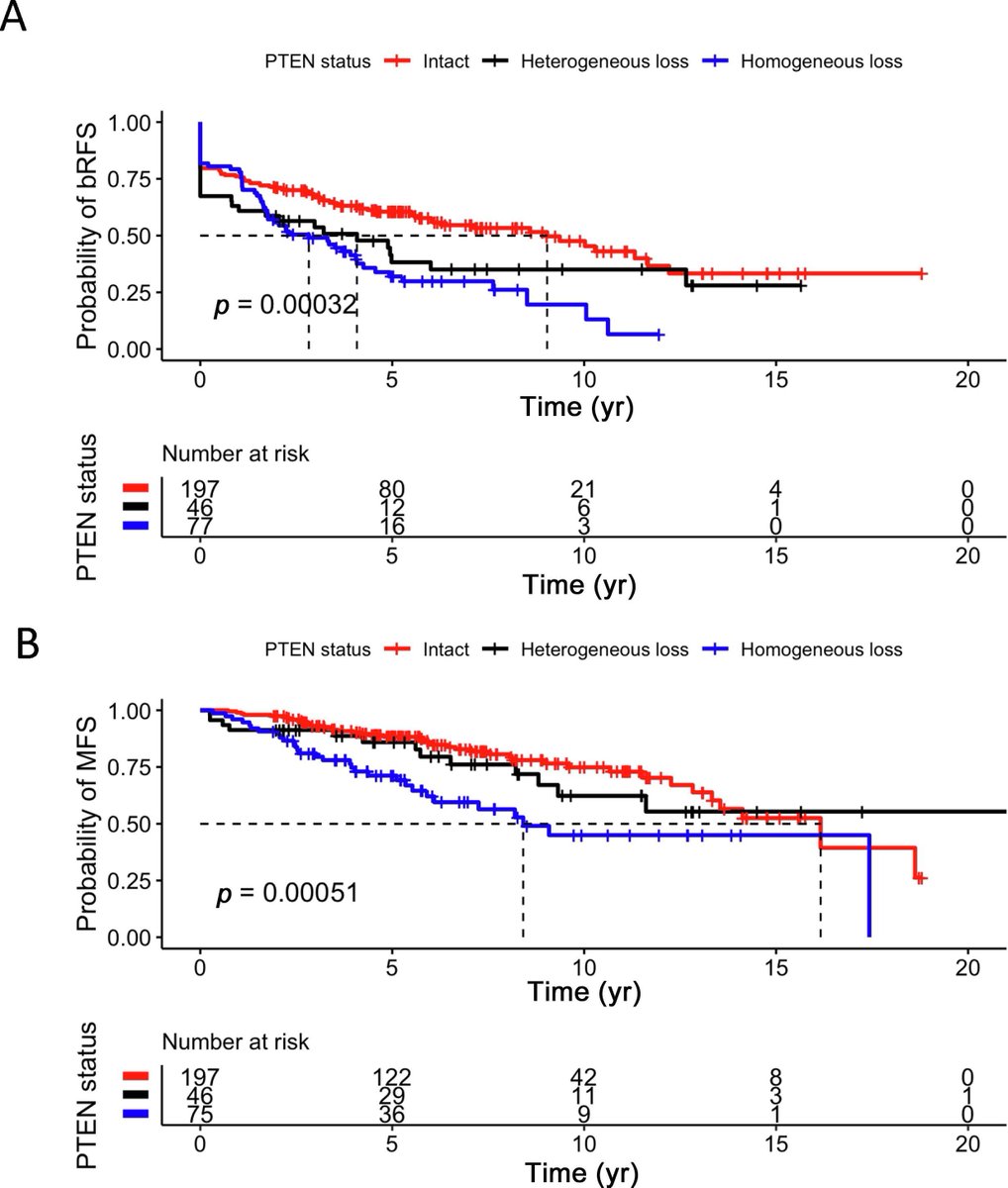 PTEN Loss Is Associated with Adverse Outcomes in the Setting of Salvage Radiation Therapy by Emerson Lee, Lia DePaula Oliveira, Oluwademilade Dairo et al

buff.ly/3BD8FEi 

#UroSoMe #MedTwitter #EUO