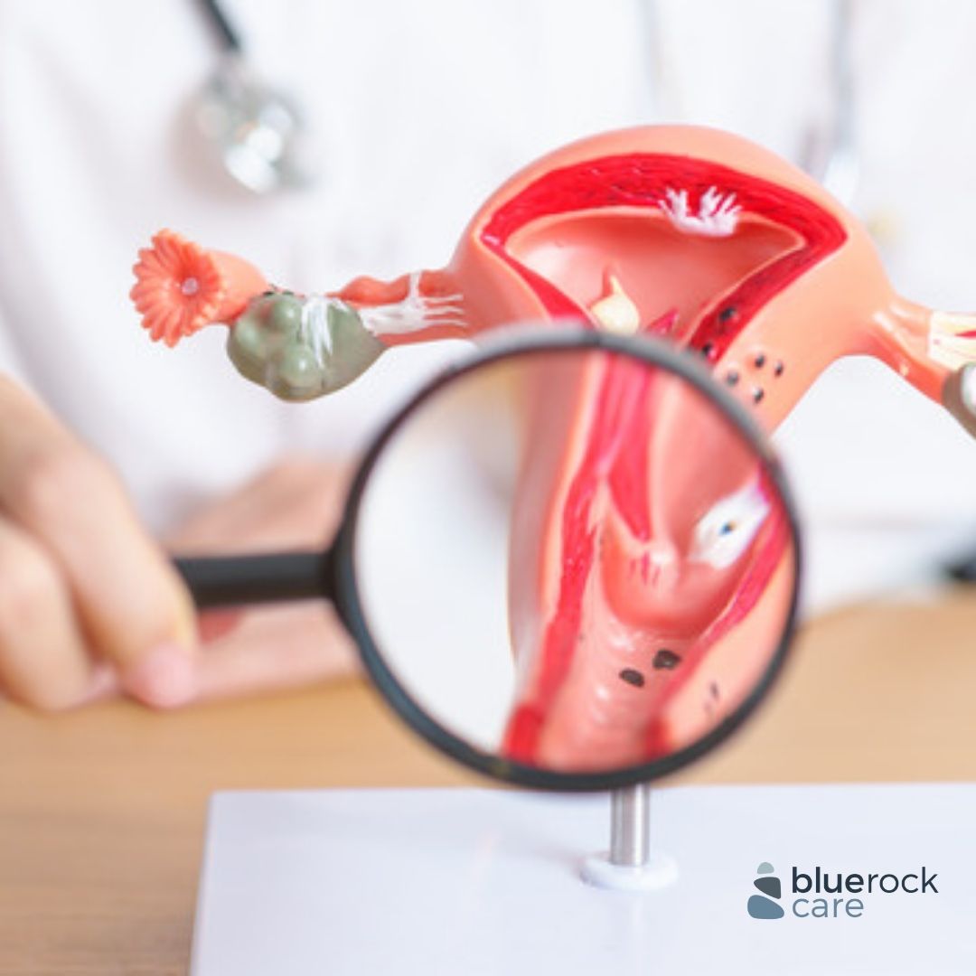 bluerockcaredc's tweet photo. Women with symptoms are not the only ones who need cervical cancer screenings. Many early cases show no symptoms. Early detection saves lives. 💜

Visit us at https://t.co/Q07Z97BPe4 or call us at (202) 796-9775 to schedule an exam with us!

 #CervicalCancerAwareness https://t.co/IbGptMnkq6