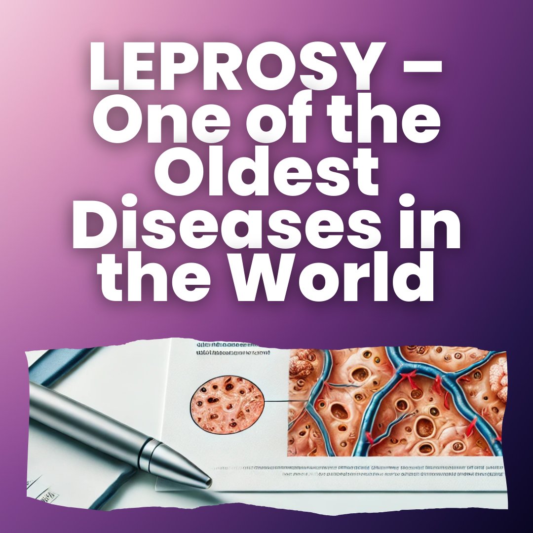 BroermannAward's tweet photo. Leprosy: an ancient disease with modern solutions.
#medicine #innovation #leprosy #Awareness #health #award https://t.co/OWXNwPMPGw