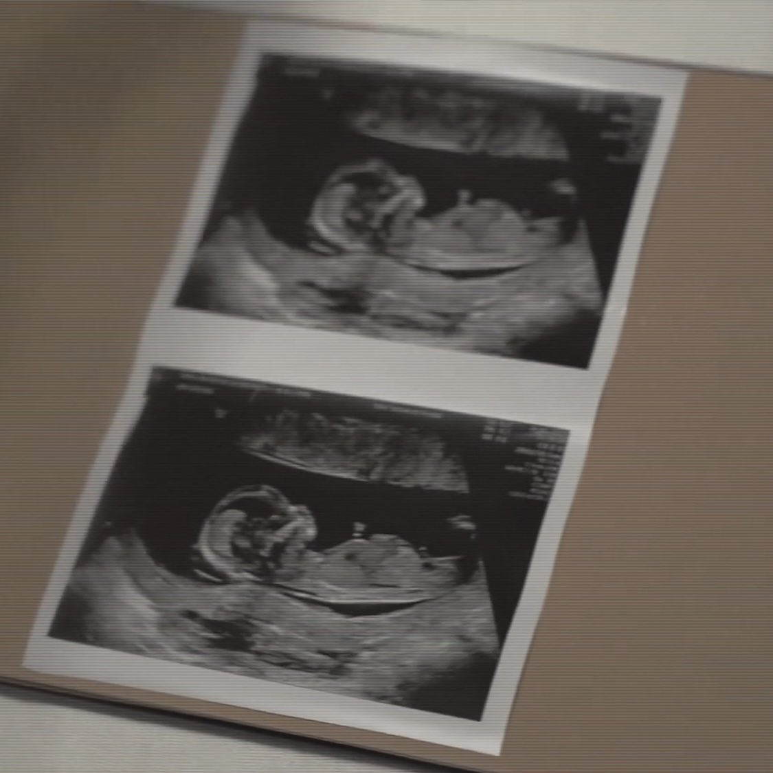 Sidemen Updates (@sdmnfcupdates) on Twitter photo Simon and Talia are having a baby!
Congratulations 🥹🤍 <a href="/miniminter/">Wedgeman Simon</a> @taliamar Simon and Talia are having a baby!
Congratulations 🥹🤍 <a href="/miniminter/">Wedgeman Simon</a> @taliamar