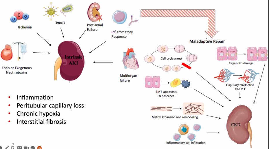 Yonca Bulut M.D. (@yoncabulutmd) on Twitter photo ⚡️50% of children with AKI will not have increase in creatinine
⚡️AKI is not a completely reversible disease
⚡️Adaptive recovery becomes maladaptive
#PedsICU <a href="/UCLAMCH/">UCLAMattelChildrens</a> Grand Rounds
#kidneyfailure #AKI
<a href="/AkcanArikan/">Ayse Akcan Arikan, MD, FAAP, FASN</a> <a href="/TexasChildrens/">Texas Children's</a> ⚡️50% of children with AKI will not have increase in creatinine
⚡️AKI is not a completely reversible disease
⚡️Adaptive recovery becomes maladaptive
#PedsICU <a href="/UCLAMCH/">UCLAMattelChildrens</a> Grand Rounds
#kidneyfailure #AKI
<a href="/AkcanArikan/">Ayse Akcan Arikan, MD, FAAP, FASN</a> <a href="/TexasChildrens/">Texas Children's</a>