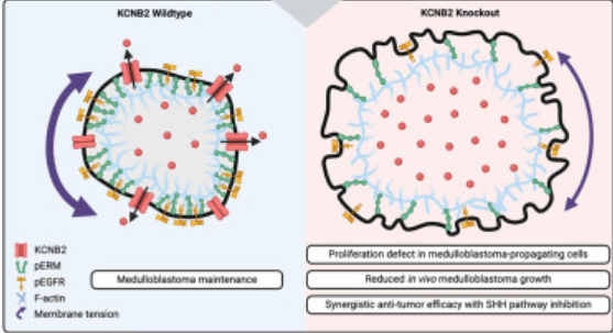 From the Labs at Baylor College of Medicine (@bcmfromthelabs) on Twitter photo Interested in #genes involved in #medulloblastoma (MB) maintenance? Using #LazyPiggy screenings, Dr. M Taylor et al identified #KCNB2 gene as a MB tumor driver and potential therapeutic target. <a href="/Dev_Cell/">Developmental Cell</a> <a href="/bcmhouston/">BCMHouston</a> <a href="/TexasChildrens/">Texas Children's</a> <a href="/SickKidsNews/">The Hospital for Sick Children (SickKids)</a> cell.com/developmental-β¦ Interested in #genes involved in #medulloblastoma (MB) maintenance? Using #LazyPiggy screenings, Dr. M Taylor et al identified #KCNB2 gene as a MB tumor driver and potential therapeutic target. <a href="/Dev_Cell/">Developmental Cell</a> <a href="/bcmhouston/">BCMHouston</a> <a href="/TexasChildrens/">Texas Children's</a> <a href="/SickKidsNews/">The Hospital for Sick Children (SickKids)</a> cell.com/developmental-β¦