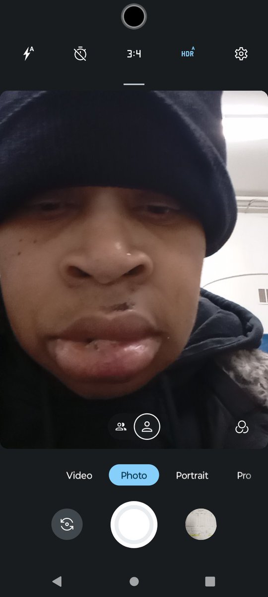 kitak14's tweet photo. Stitches under my lip &amp; inside my mouth https://t.co/UWifrJJ4zn
