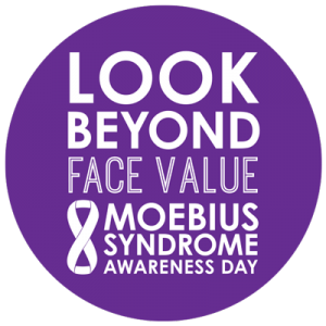 David Matsumoto (@davidmatsumoto) on Twitter photo Today is Moebius Syndrome Awareness Day.
While often ignored, a better understanding of this rare condition can lead to a better understanding of facial expressions – and the people who cannot show them.
Read our blog ft <a href="/kathleen_bogart/">Dr. Kathleen Bogart 🦓</a>
humintell.com/2017/01/living… Today is Moebius Syndrome Awareness Day.
While often ignored, a better understanding of this rare condition can lead to a better understanding of facial expressions – and the people who cannot show them.
Read our blog ft <a href="/kathleen_bogart/">Dr. Kathleen Bogart 🦓</a>
humintell.com/2017/01/living…