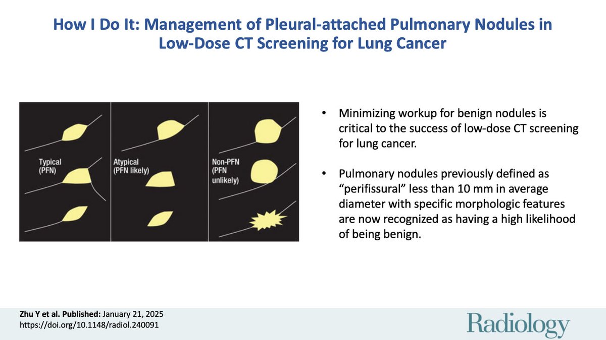 Introducing our first ‘How I Do It’ article! 🫁 Updated guidelines for low-dose CT lung cancer screening now classify certain pleural-attached nodules as likely benign, recommending annual follow-up instead of short-term. #LungCancer #Radiology
pubs.rsna.org/doi/10.1148/ra…