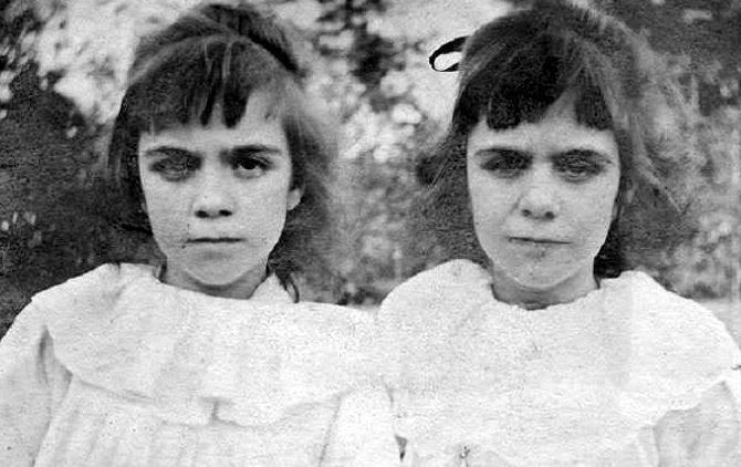 thedarshakrana's tweet photo. But what happened next is where it gets strange.

A year after the accident, their mother gave birth to twins:

Jennifer and Gillian.

From the moment they could talk, the twins displayed behaviors that defied explanation. https://t.co/dCjYTFoSSU