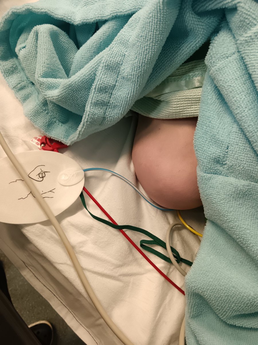 Claire Hayward (she/her) (@flowocctherapy) on Twitter photo #epilepsy is just so cruel. Our thanks to <a href="/WMASMERIT/">WMAS MERIT</a> <a href="/Bham_Childrens/">Bham Children's Hosp 💙</a> ED, neurology and neurosurgery teams and our sons <a href="/ComplexcareBCHC/">Childrens Complex Care BCHC</a> carers this week #epilepsy is just so cruel. Our thanks to <a href="/WMASMERIT/">WMAS MERIT</a> <a href="/Bham_Childrens/">Bham Children's Hosp 💙</a> ED, neurology and neurosurgery teams and our sons <a href="/ComplexcareBCHC/">Childrens Complex Care BCHC</a> carers this week