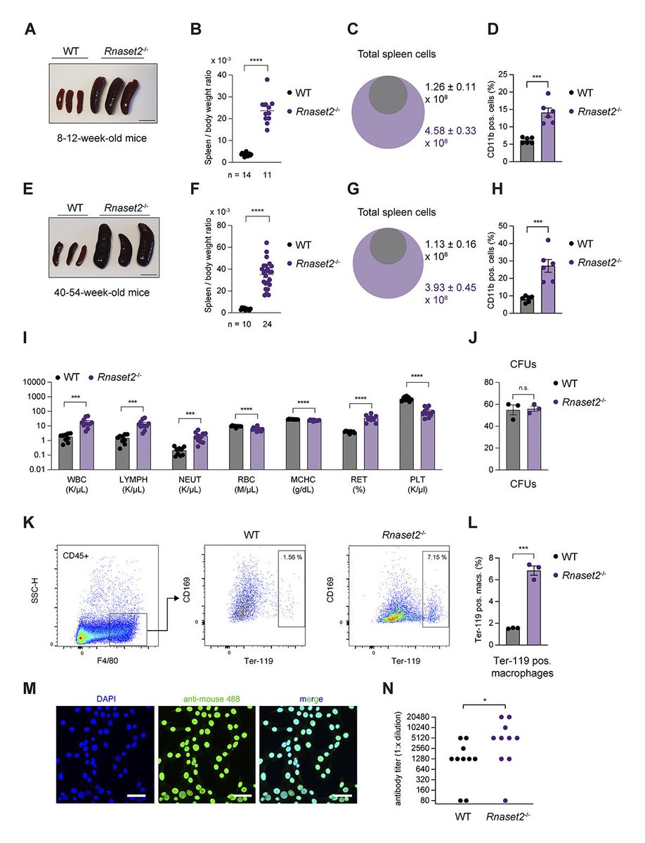 Journal of Experimental Medicine (@jexpmed) on Twitter photo Gomez-Diaz, <a href="/v_hornung/">Veit Hornung</a> et al <a href="/LMU_Muenchen/">Universität München</a> show that mice lacking RNase T2 display an inflammatory phenotype in a TLR13-dependent manner, even under germ-free conditions, suggesting that RNase T2 plays an important role in limiting self-RNA recognition hubs.la/Q033XwBh0 Gomez-Diaz, <a href="/v_hornung/">Veit Hornung</a> et al <a href="/LMU_Muenchen/">Universität München</a> show that mice lacking RNase T2 display an inflammatory phenotype in a TLR13-dependent manner, even under germ-free conditions, suggesting that RNase T2 plays an important role in limiting self-RNA recognition hubs.la/Q033XwBh0