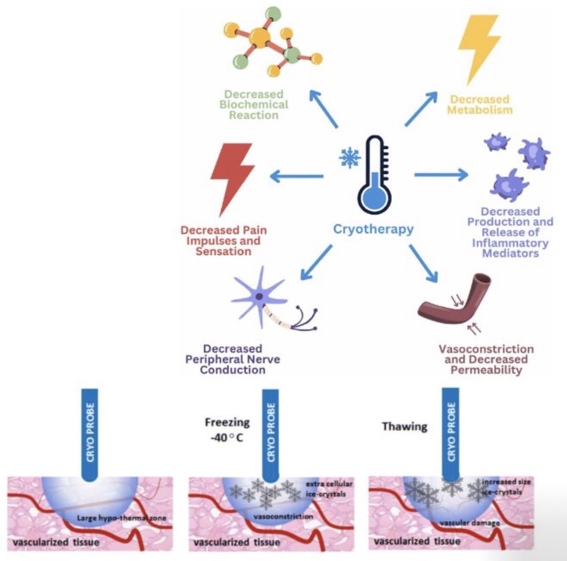 Role of cryotherapy in plastic surgery: mechanisms, applications, and future directions by @hatanmortada from 🇸🇦 

link.springer.com/article/10.100…?