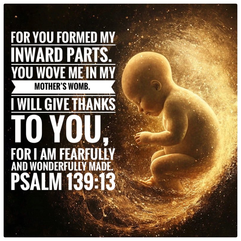 GordonHarmony's tweet photo. @BehizyTweets I sometimes wonder how many people are looking for their mate and can't find them because they were ab0rted ?

We are missing a huge number of people who were denied the right to life. 😭💔

I am thankful to each person who is marching on Washington DC in the PRO-LIFE March https://t.co/41F1LnUtRX