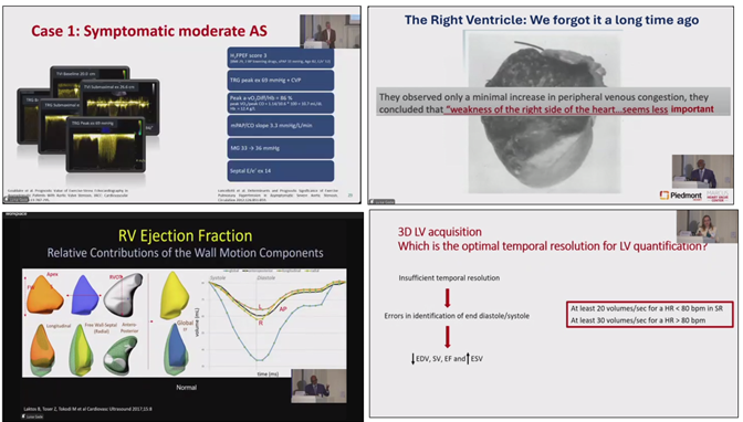 NabilNaser11's tweet image. Fantastic first-day #3DEchoBerlin #echofirst Workshop by β¦@DHZB_Akademieβ© at β¦@dhzcharite. Congrats to @NM and other masters of 3D echocardiography.πβ₯οΈπ