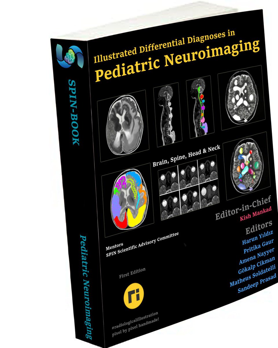 spinacademics's tweet photo. The #SPINBOOK is releasing soon….Your illustrated guide to differential diagnoses in Pediatric Neuroimaging. Our editors are working hard to get this one completed. Thank you in advance to all our wonderful contributors. As we say, when it’s innovating, then it’s spinning! https://t.co/vXNKL1BDRp
