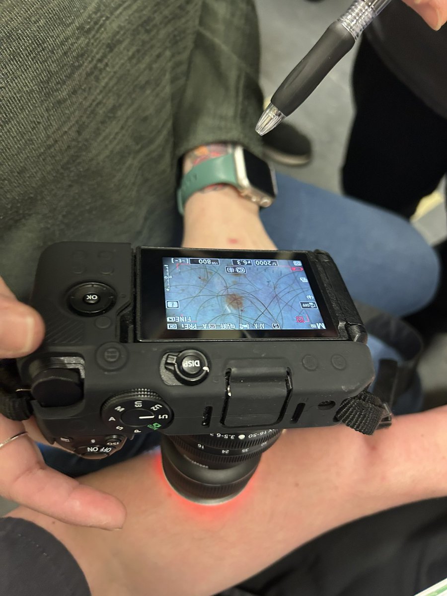 L_RichardsPhoto's tweet photo. We welcomed @SchucoUK here today at @CwmTafMorgannwg who showed us how to use the fantastic features of the @Dermlite DL5’s we have! 

Can’t wait to put these into action in our standard derm clinics and teledermoscopy 🤓📸 https://t.co/WERFlxKSrr