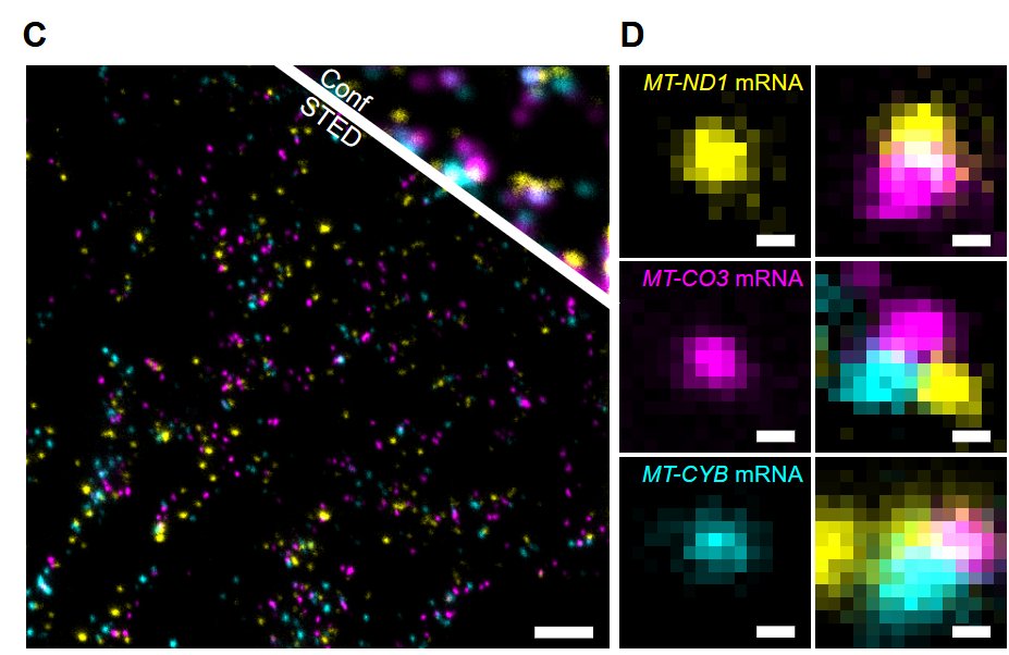 Volodymyr Nechyporuk-Zloy (@vnzloy) on Twitter photo Super-resolution microscopy of mitochondrial mRNAs
Stefan Stoldt, Frederike Maass, Michael Weber, Sven Dennerlein, Peter Ilgen, Jutta Gaertner, Aysenur Canfes, Sarah V. Schweighofer, Daniel C. Jans, Peter Rehling and Stefan Jakobs
biorxiv.org/content/early/… Super-resolution microscopy of mitochondrial mRNAs
Stefan Stoldt, Frederike Maass, Michael Weber, Sven Dennerlein, Peter Ilgen, Jutta Gaertner, Aysenur Canfes, Sarah V. Schweighofer, Daniel C. Jans, Peter Rehling and Stefan Jakobs
biorxiv.org/content/early/…