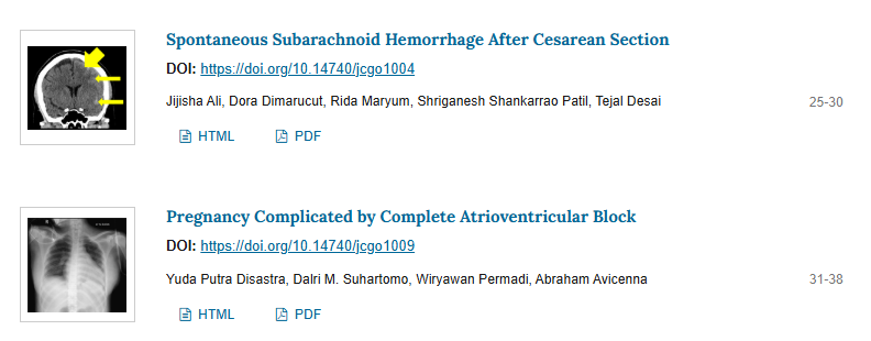 New Issue Out!!!!  
Read our latest published articles in Journal of Clinical Gynecology and Obstetrics
jcgo.elmerpub.com/index.php/jcgo…