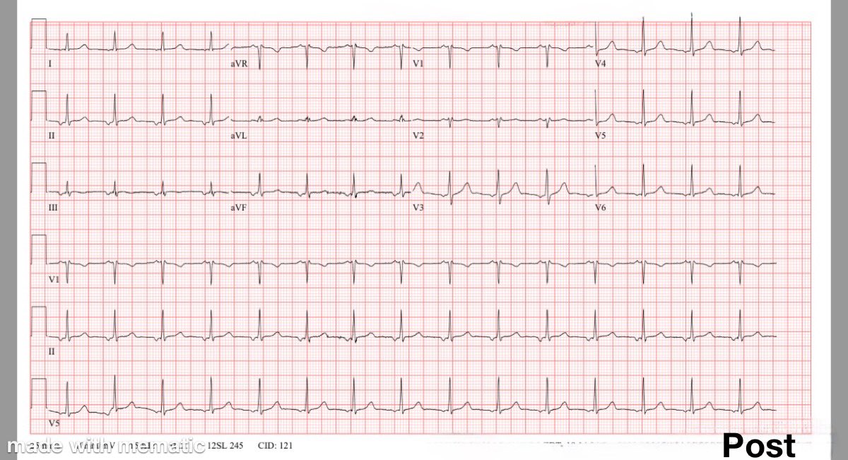 Chi Zhang, MD tweet media