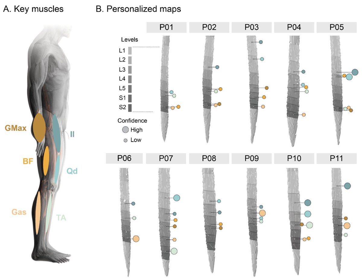 New paper in Imaging Neuroscience by Sergio Daniel Hernandez-Charpak, Dimitri Van De Ville, et al:

Towards personalized mapping through lumbosacral spinal cord task fMRI

doi.org/10.1162/imag_a…