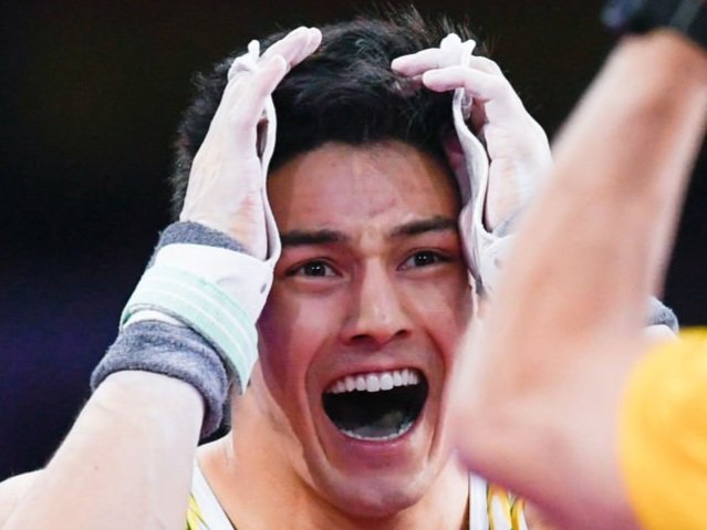 mushiba18's tweet photo. 【イケメン外国人の歯】No.2
アルトゥール・ノリ(Arthur Nory)選手(31歳(22~26歳)(1993年生)、🇧🇷、体操)

左上6　アマルガム
右上6　アマルガム
右下6　アマルガム
左下6　アマルガム(？)
他不明
#虫歯 #銀歯 #体操 #ブラジル https://t.co/zL9P8AK7o4