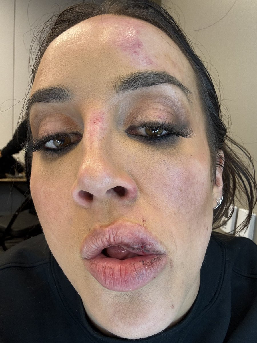 ImChelseaGreen's tweet photo. Update: 
B Flop &amp; Messy Michin will pay!!!!! 
cc: @WWE #SmackDown https://t.co/1FMF5HRxpY