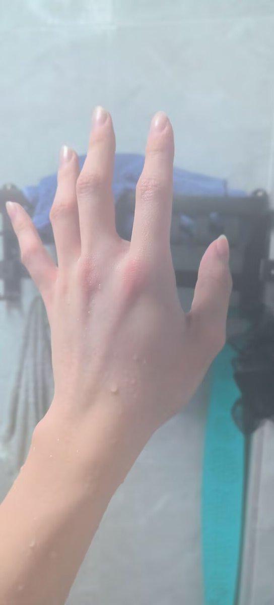 mayodeeeeeer's tweet photo. 🦌🖐️ https://t.co/HMjCQrMILd