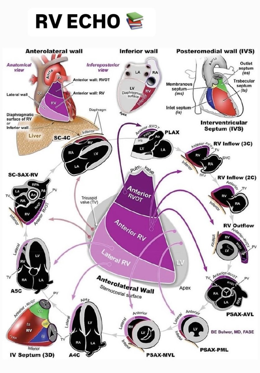 RV focused echocardiography 📚
