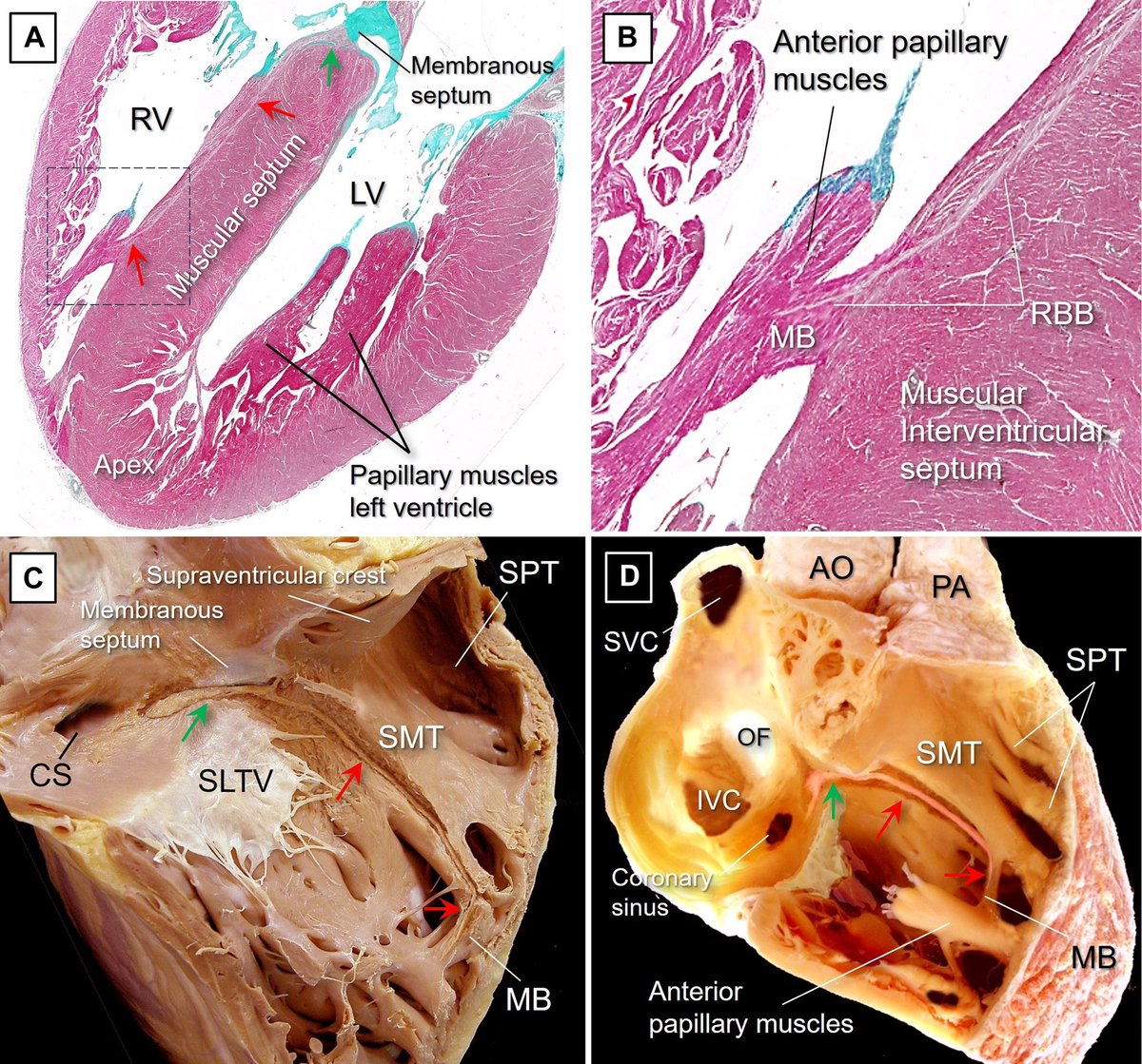 Cardiac Anatomy tweet media