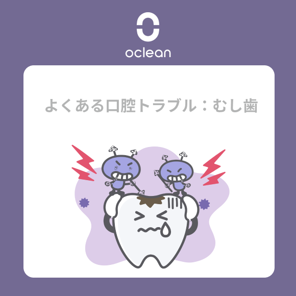 Oclean_JP's tweet photo. ＜よくある口腔トラブル：むし歯＞

歯の表面に黒い線や小さな穴が現れ、痛みや不快感を感じることがあります😫
放置しておくと、細菌が歯の奥深くに侵入し、最悪の場合、歯髄まで感染する恐れも…😱

対策：
❶ 🏥歯科医院で早期治療を受け、詰め物で対処する。
❷フッ素入りの歯磨き粉を使って、口腔洗浄器やフッ素入りマウスウォッシュで口内をしっかり清潔に保つ。
➌甘いものを控えめにして、むし歯予防を心がけよう👩‍⚕️。

#口臭対策 #口腔健康 #口腔ケア ＃オーラルケア ＃歯周病 ＃電動歯ブラシ  #ジェットウォッシャー #口腔洗浄器