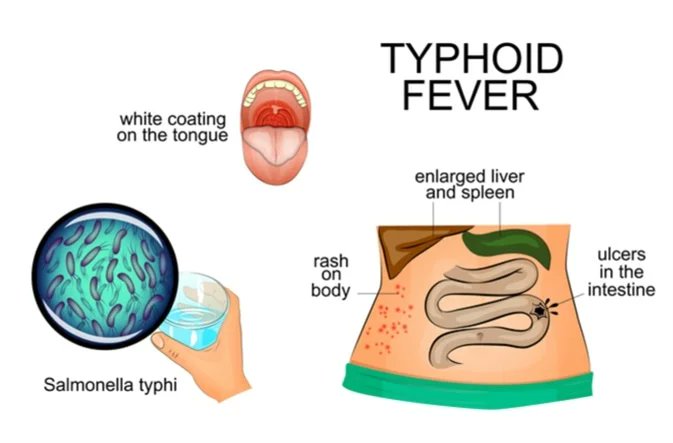 BorneWater's tweet photo. Air and waterborne diseases are caused by pollutants and pathogens in the air and water we rely on. Protecting our environment and improving sanitation is key to preventing these health threats. #AirborneDiseases #WaterborneDiseases #PublicHealth #callforpaper https://t.co/xUhtOakZcP
