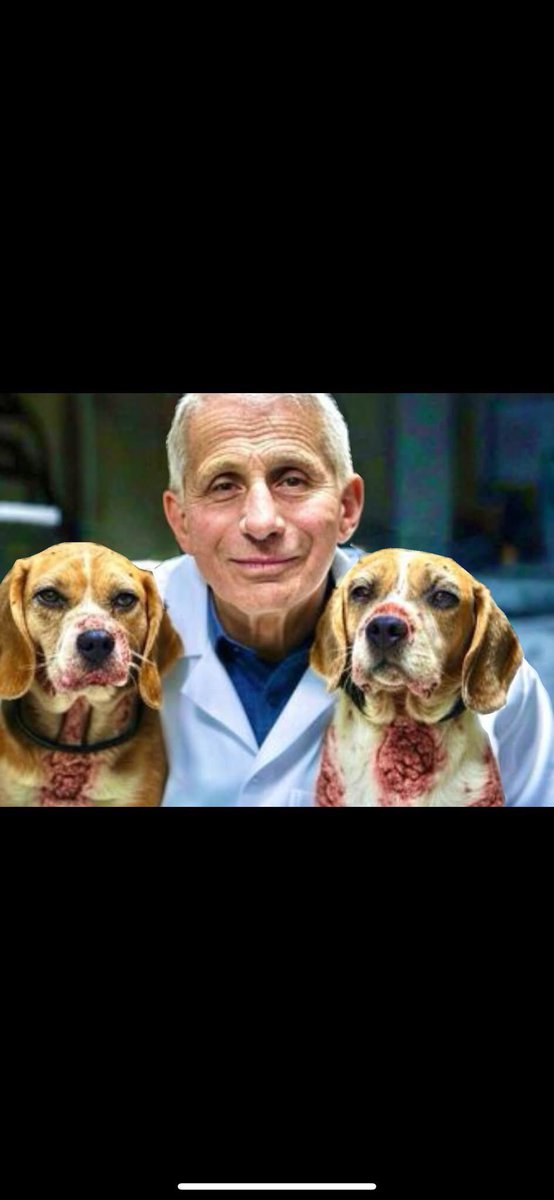 The Beagles should have bit his neck.