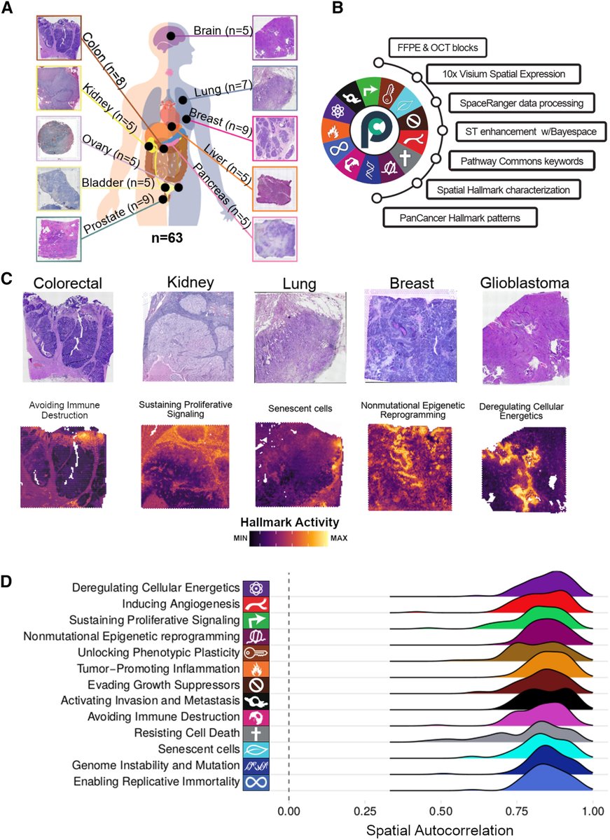 Manel Esteller (@manelesteller) on Twitter photo Thrilled to introduce our Cell Reports @cellreports
article, showing how the iconic '#Hallmarks of #Cancer' are located in the space of real human primary tumors. A team effort co-led by Eduard Porta <a href="/eportacangen/">Eduard Porta</a> , Matthew H. Bailey, and yours truly. #SpatialBiology #Visium Thrilled to introduce our Cell Reports @cellreports
article, showing how the iconic '#Hallmarks of #Cancer' are located in the space of real human primary tumors. A team effort co-led by Eduard Porta <a href="/eportacangen/">Eduard Porta</a> , Matthew H. Bailey, and yours truly. #SpatialBiology #Visium