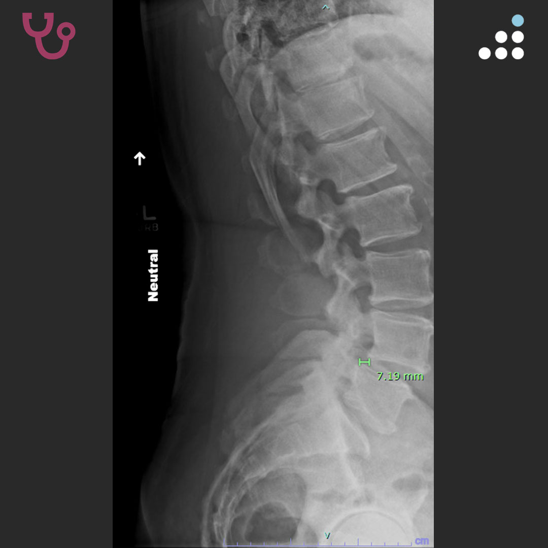 Orthobullets tweet media