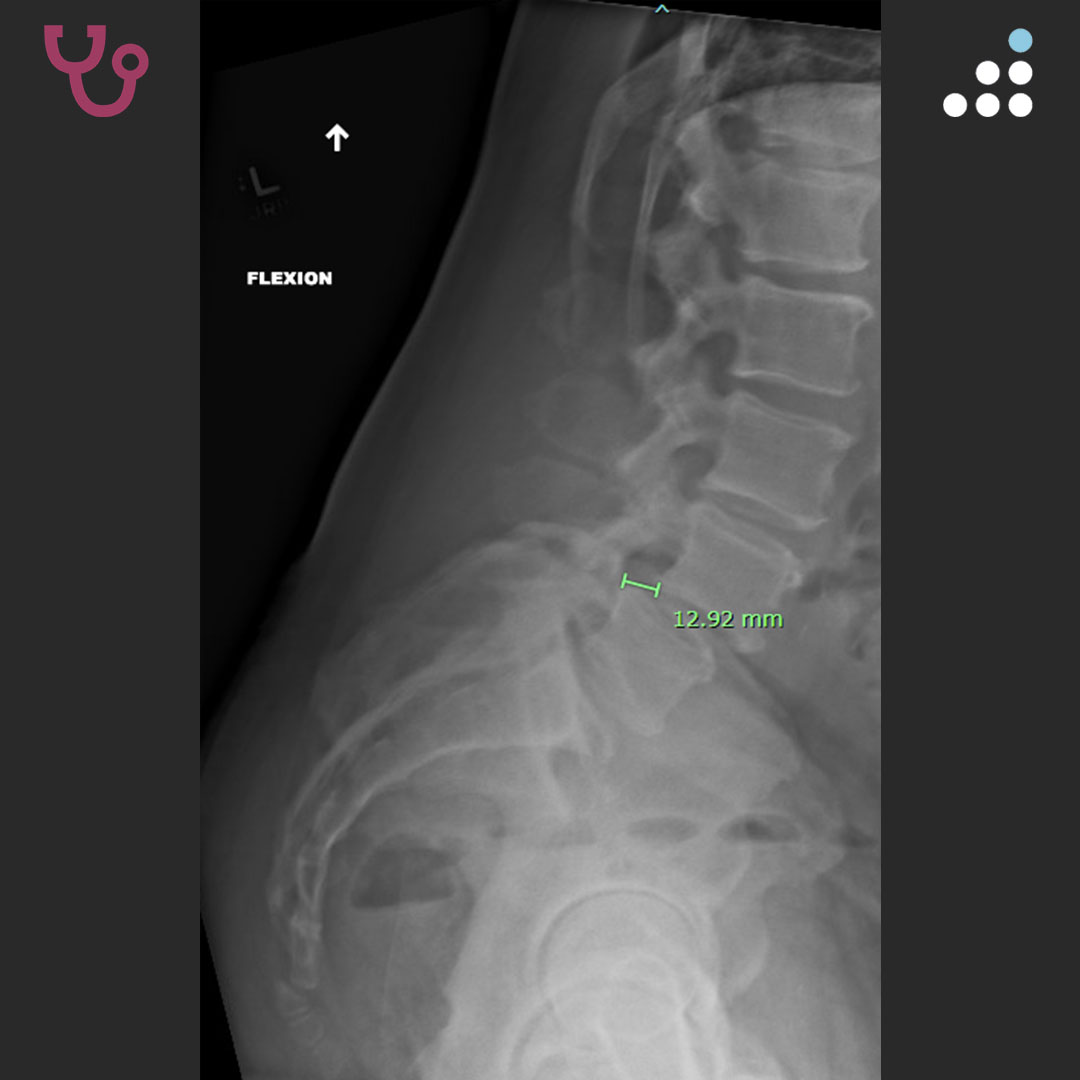 Orthobullets tweet media